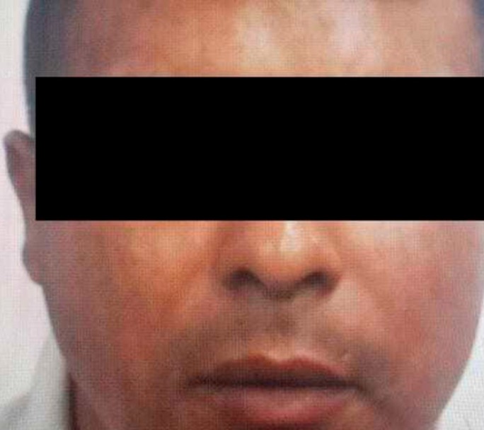 El "tirador de Retiro" recibió tres disparos y analizan amputarle una pierna