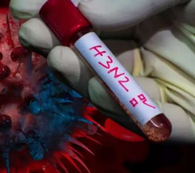 Aumentan los casos de «supergripe» H3N2 en Argentina y preocupa una posible circulación local