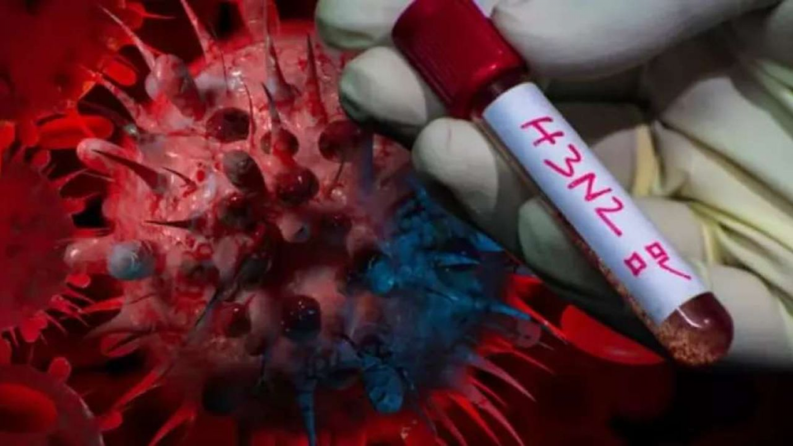 Aumentan los casos de «supergripe» H3N2 en Argentina y preocupa una posible circulación local