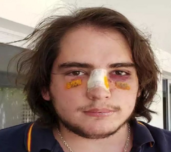 Denuncian a cuatro rugbiers por una brutal golpiza a un joven en Córdoba