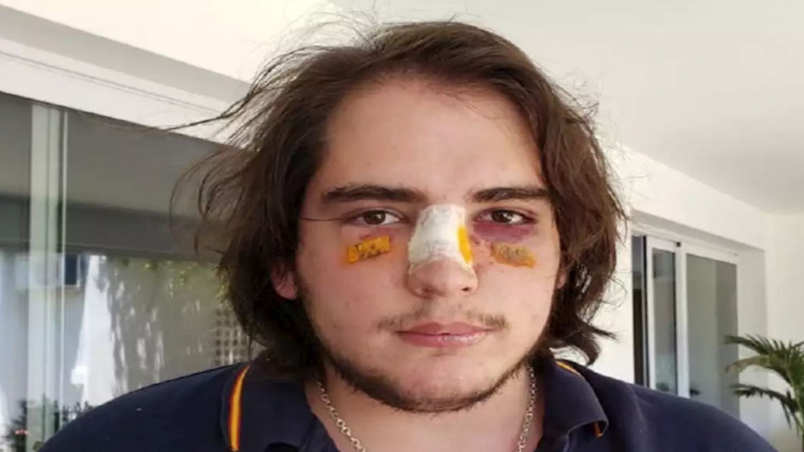 Denuncian a cuatro rugbiers por una brutal golpiza a un joven en Córdoba