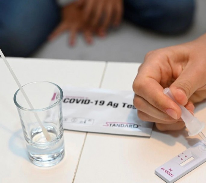 Las farmacias podrán vender autotest a partir de Enero