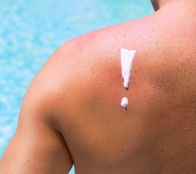 Cómo proteger la piel del sol en verano