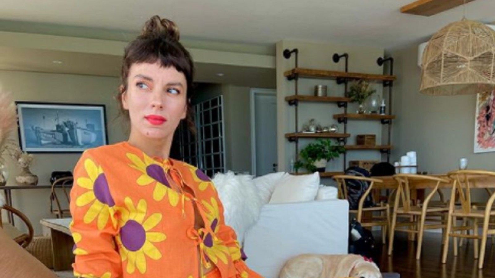 Gimena Accardi luego de una "cirugía de 4 horas"