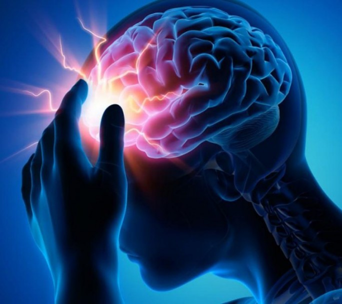 Más de 15 millones de personas sufren un ACV cada año