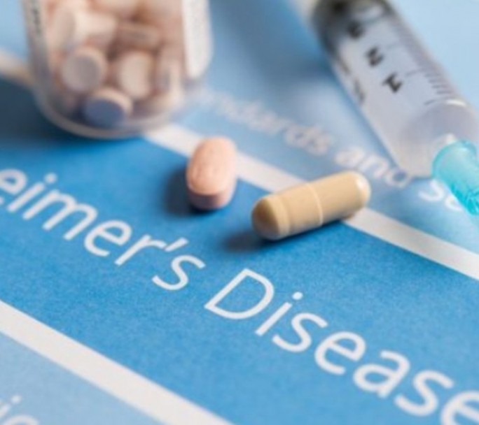 Nuevo fármaco para tratar el Alzheimer calificado como "histórico y trascendental"