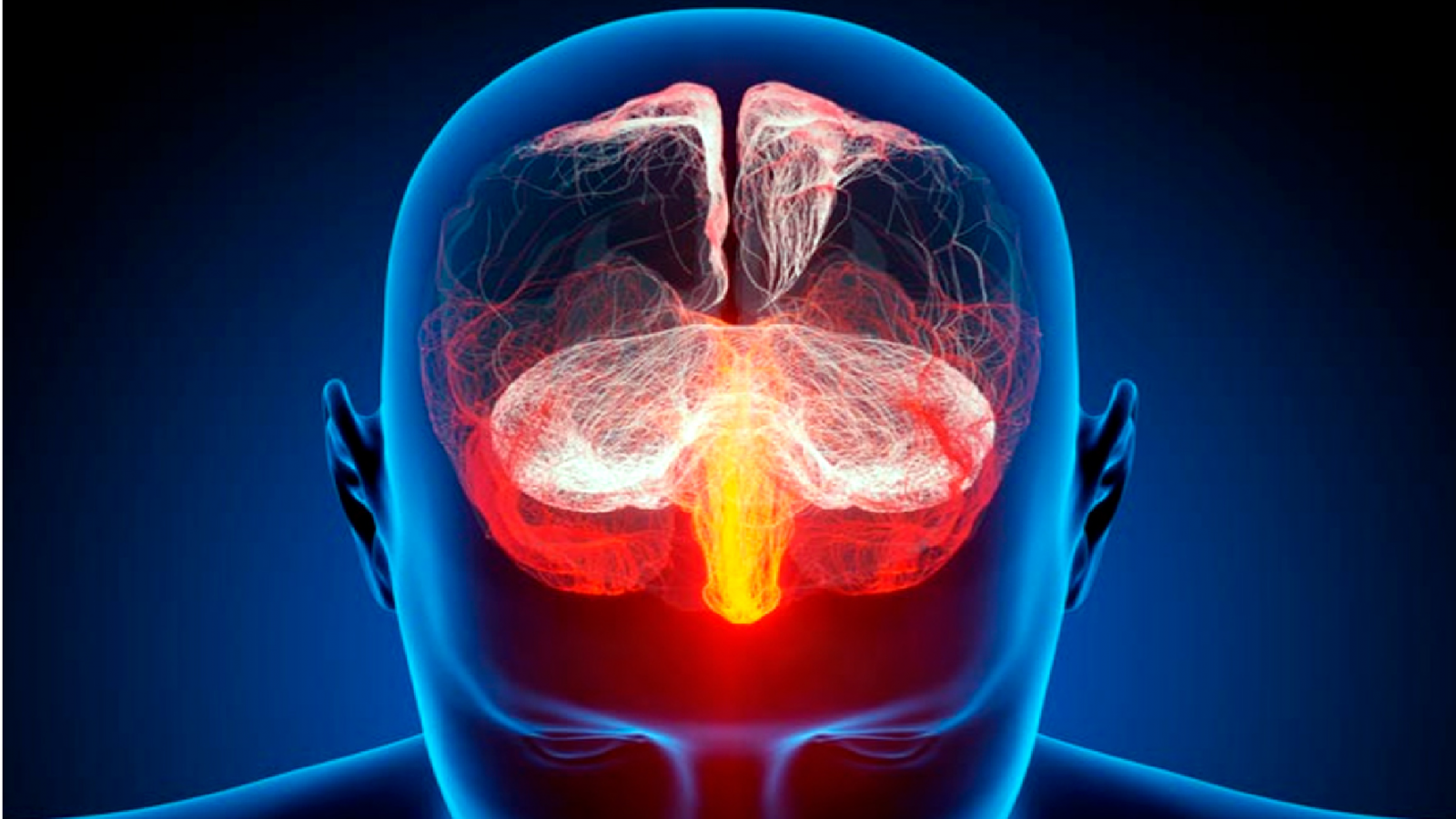 Cada año 120 mil argentinos sufren un ACV