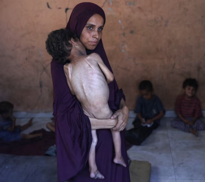 La hambruna en Gaza, un infierno provocado, según una enfermera de MSF